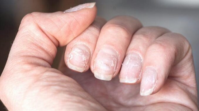 Natürliche Nagelpflege zu Hause - BlauBahn