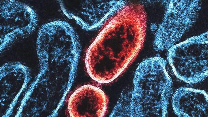 Nipah-Virus: Überblick, Übertragung und Gefahr - BlauBahn