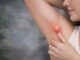 Schwellung unter dem Arm – nicht immer harmlos - BlauBahn