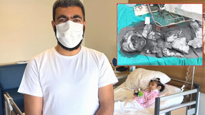 Schockierende Operation: 3 Kilogramm schwerer Tumor beim Patienten entfernt - BlauBahn