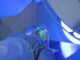 Neue Generation der Radiotherapie schützt gesundes Gewebe effektiver - BlauBahn