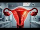 Chemicals Exponated to in the Womb and Cancer Risk - BlauBahn